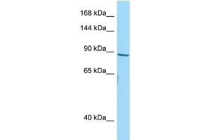 Western Blotting (WB) image for anti-Neuroblastoma Breakpoint Family, Member 10 (NBPF10) (C-Term) antibody (ABIN2790662) (NBPF10 抗体  (C-Term))