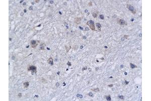Formalin-fixed and paraffin embedded rat brain labeled with Anti-APAF1(NT) Polyclonal Antibody, Unconjugated (ABIN724310) followed by conjugation to the secondary antibody and DAB staining (APAF1 抗体  (AA 13-80))