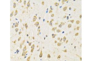 Immunohistochemistry of paraffin-embedded Mouse brain using PTPRE Polyclonal Antibody at dilution of 1:100 (40x lens). (PTPRE 抗体)
