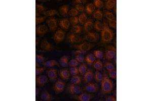 Immunofluorescence analysis of HeLa cells using V antibody  at dilution of 1:100. (VAV3 抗体  (AA 560-680))
