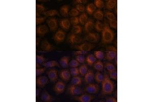 Immunofluorescence analysis of HeLa cells using V antibody  at dilution of 1:100. (VAV3 抗体  (AA 560-680))