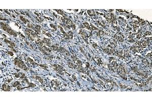 IHC analysis of CDC45L using anti-CDC45L antibody (ABIN7600230).