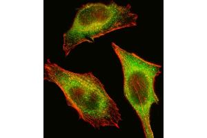 Fluorescent image of Hela cell stained with TEC Antibody (Center) (ABIN392111 and ABIN2841862). (NR4A3 抗体  (AA 175-205))