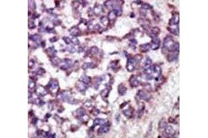Immunohistochemistry (IHC) image for anti-LATS, Large Tumor Suppressor, Homolog 1 (Drosophila) (LATS1) (AA 1-30) antibody (ABIN3031593)