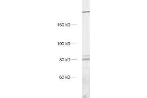 dilution: 1 : 1000, sample: crude synaptosomal fraction of rat brain (P2) (ITPR1 抗体)