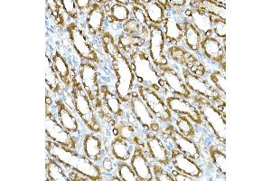 Immunohistochemistry (IHC) image for anti-Ras Homolog Gene Family, Member T2 (RHOT2) (AA 280-480) antibody (ABIN1682532)