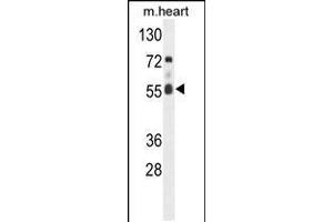 Western blot analysis of hFASTK-R534 in mouse heart tissue lysates (35ug/lane) (FASTK 抗体  (C-Term))