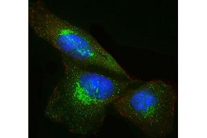 Immunofluorescent analysis of 4 % paraformaldehyde-fixed, 0. (DKK1 抗体  (AA 1-266))