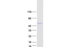 Validation with Western Blot (PDLIM7 Protein (Transcript Variant 2) (Myc-DYKDDDDK Tag))