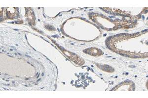 ABIN6267611 at 1/100 staining Human prostate tissue by IHC-P. (LIPE 抗体  (pSer554, pSer855))