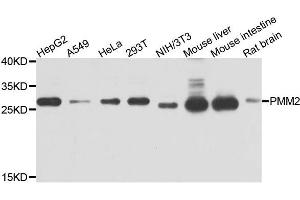 Western blot analysis of extracts of various cells, using PMM2 antibody. (PMM2 抗体)