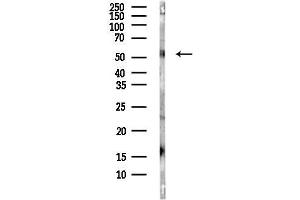 anti-Nicotinamide phosphoribosyltransferase (NAMPT) (C-Term) antibody