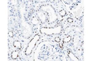 ABIN6267462 at 1/100 staining human kidney tissue sections by IHC-P. (Cyclin D3 抗体  (pThr283))