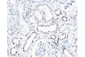 ABIN6267462 at 1/100 staining human kidney tissue sections by IHC-P.