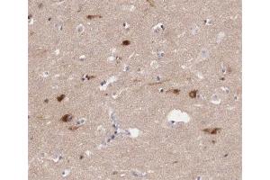 ABIN6267409 at 1/200 staining human brain tissue sections by IHC-P. (JunB 抗体  (pSer259))