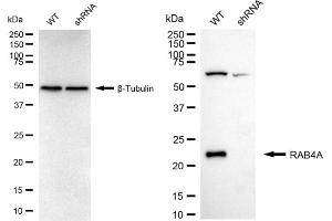 Western blotting analysis using RAB4A antibody (ABIN7800097).