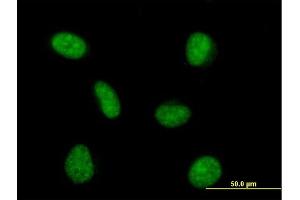 Immunofluorescence of purified MaxPab antibody to PRPF4 on HeLa cell.
