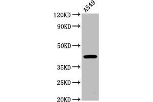 Western Blot Positive WB detected in: A549 whole cell lysate All lanes: CHST14 antibody at 4. (CHST14 抗体  (AA 70-133))