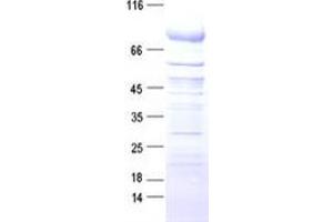 Western Blotting (WB) image for Transmembrane Protease, serine 6 (TMPRSS6) protein (DYKDDDDK Tag) (ABIN2733932)