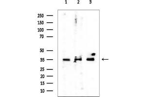 anti-RWD Domain Containing 2B (RWDD2B) antibody
