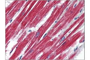 Human Heart (formalin-fixed, paraffin-embedded) stained with LEPRat 4 µg/ml followed by biotinylated anti-goat IgG secondary antibody, alkaline phosphatase-streptavidin and chromogen. (Leptin Receptor 抗体  (Internal Region))