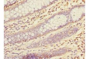 Immunohistochemistry (IHC) image for anti-Ketohexokinase (KHK) (AA 1-298) antibody (ABIN7157477)