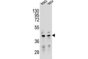Western Blotting (WB) image for anti-Transcription Factor B2, Mitochondrial (TFB2M) antibody (ABIN2995537) (TFB2M 抗体)