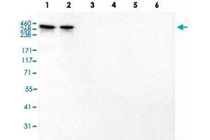 Western Blot analysis of recombinant protein Lane 1: Laminin-211, Lane 2: Laminin-221, Lane 3: Laminin-332, Lane 4: Laminin-421, Lane 5: Laminin-511 and Lane 6: Laminin-121 with LAMA2 monoclonal antibody, clone CL3450 . (Laminin 抗体)