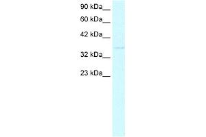 WB Suggested Anti-CDX4 Antibody Titration:  0. (CDX4 抗体  (C-Term))