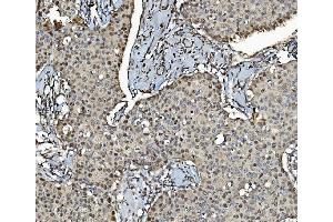 IHC analysis of MCM4 using anti-MCM4 antibody (ABIN7601485). (MCM4 抗体  (AA 361-677))