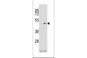 Western blot analysis of P2K1 (arrow) using rabbit polyclonal P2K1 Antibody  (ABIN392479 and ABIN2842059). (MEK1 抗体  (AA 196-225))