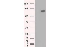 HEK293T cells were transfected with the pCMV6-ENTRY control (Left lane) or pCMV6-ENTRY USP5 (Right lane) cDNA for 48 hrs and lysed. (USP5 抗体)