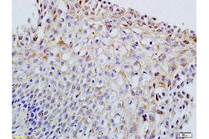 Formalin-fixed and paraffin embedded rat ovary labeled with Anti-FSH/FSHB Polyclonal Antibody, Unconjugated  at 1:200 followed by conjugation to the secondary antibody and DAB staining (FSHB 抗体  (AA 61-98))