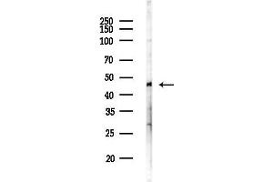 Western blot analysis of lysates from HepG2 cells(LPS,4h treatment), using ZNF524 Antibody at 1/1000 dilution.