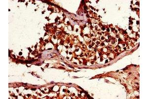 Immunohistochemistry of paraffin-embedded human testis tissue using ABIN7151222 at dilution of 1:100 (SMURF1 抗体  (AA 198-374))