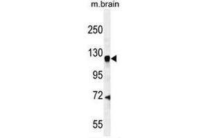 CENTG1 Antibody (C-term) western blot analysis in mouse brain tissue lysates (35µg/lane). (AGAP2 抗体  (C-Term))