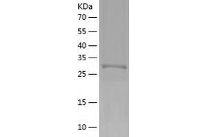 Western Blotting (WB) image for Nicotinamide Nucleotide Adenylyltransferase 1 (NMNAT1) (AA 1-285) protein (His tag) (ABIN7124172) (NMNAT1 Protein (AA 1-285) (His tag))