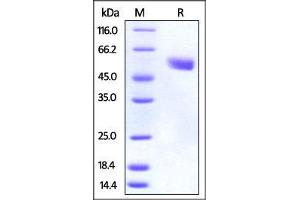 SDS-PAGE (SDS) image for Cytotoxic T-Lymphocyte-Associated Protein 4 (CTLA4) (AA 36-162) (Active) protein (Fc Tag) (ABIN2870731)