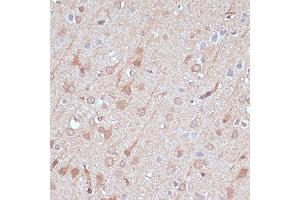 Immunohistochemistry of paraffin-embedded rat brain using  antibody (ABIN7265470) at dilution of 1:100 (40x lens). (Adenylate Kinase 5 抗体  (AA 150-370))