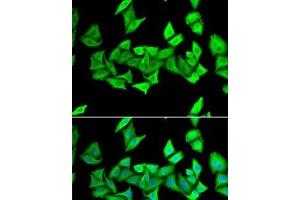 Immunofluorescence analysis of U2OS cells using H6PD Polyclonal Antibody (Glucose-6-Phosphate Dehydrogenase 抗体)