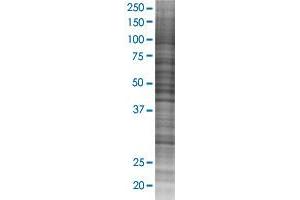 SNAP29 transfected lysate. (SNAP29 293T Cell Transient Overexpression Lysate(Denatured))