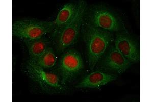 IF analysis of Angiogenin/ANG using anti-Angiogenin/ANG antibody (ABIN4886457) and anti-Beta Tubulin antibody (ABIN7602743). (ANG 抗体  (AA 25-147))