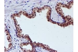 Image no. 1 for anti-Spermine Synthase, SMS (SMS) antibody (ABIN1501093) (SMS 抗体)
