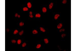 Immunofluorescence (IF) image for anti-Bromodomain Containing 2 (BRD2) (AA 1-50) antibody (ABIN7453387) (BRD2 抗体  (AA 1-50))