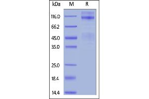 SDS-PAGE (SDS) image for Insulin-Like Growth Factor 1 Receptor (IGF1R) (AA 31-936) protein (His tag) (ABIN6253547)