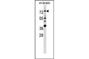 Western blot analysis of Estrogen receptor alpha  Antibody  in mouse brain tissue lysates (35ug/lane). (Estrogen Receptor alpha 抗体  (AA 53-301))
