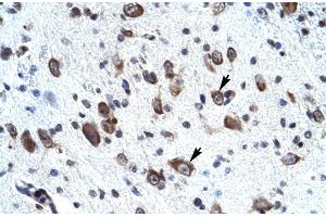 Rabbit Anti-MORF4L2 Antibody ,Paraffin Embedded Tissue: Human neural cell  Cellular Data: Epithelial cells of renal tubule  Antibody Concentration: 4. (MORF4L2 抗体  (N-Term))