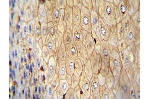 Immunohistochemistry (IHC) image for anti-Actin, beta (ACTB) antibody (ABIN3028446)