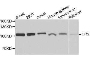 Western blot analysis of extracts of various cell lines, using CR2 antibody. (CD21 抗体  (AA 300-590))