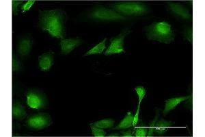 Immunofluorescence (IF) image for anti-UDP-GlcNAc:betaGal beta-1,3-N-Acetylglucosaminyltransferase 3 (B3GNT3) (AA 135-208) antibody (ABIN523730)